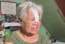 74-Year-Old Grandmother Injured in Hit-and-Run in Marikina