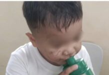 Young Boy Bullied & Marked on the Face by Classmates