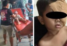 5-Year-Old Boy Loses Sight in Left Eye After Firecracker Accident in Iloilo