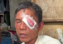 E-trike Drivers Bite Each Other Over Dispute for Passengers