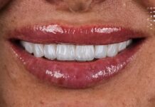 Which dental clinic abroad is the best in Istanbul, Turkey?