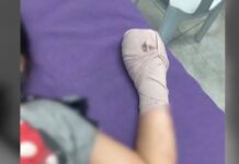 10-Year-Old Girl Loses Hand After Dart Bomb Blast in Manila