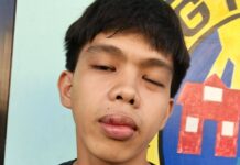 Lady Netizen Shares Brother’s Suffering After Being Beaten by Several Men