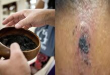 Parishioners Speak Out After Experiencing Burns from Ash Wednesday Ashes