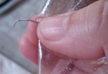 Woman Alarmed After Husband Swallows Staple Wire from Bought Cooked Meal