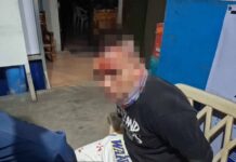 Robbery Suspect Arrested After Being Chased & Hit by Car in Bacolod