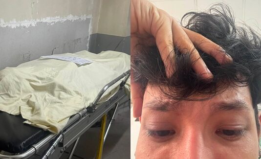 Angry Son Calls Out 911 After Father Dies While Waiting for Emergency Help