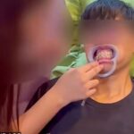 Woman Arrested in Iloilo City for Alleged Illegal DIY Braces Service Learned Online