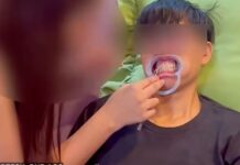 Woman Arrested in Iloilo City for Alleged Illegal DIY Braces Service Learned Online