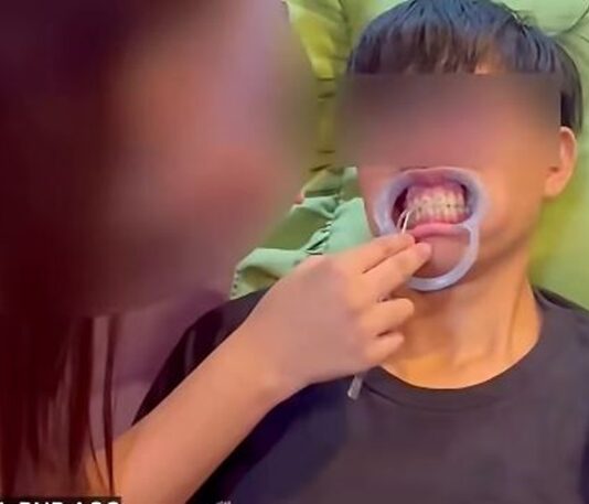 Woman Arrested in Iloilo City for Alleged Illegal DIY Braces Service Learned Online