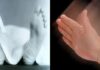 Six-Year-Old Student Dies After Teacher Allegedly Slaps Him Over Incomplete Assignment