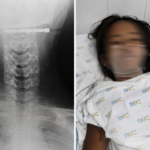 Stray Arrow Injures Student at School in Isabela