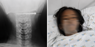 Stray Arrow Injures Student at School in Isabela