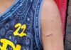 Grade 7 Student Suffers Injuries After Alleged Beating by Teacher in Bacolod