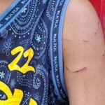 Grade 7 Student Suffers Injuries After Alleged Beating by Teacher in Bacolod