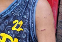 Grade 7 Student Suffers Injuries After Alleged Beating by Teacher in Bacolod