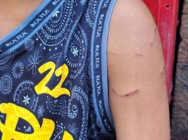 Grade 7 Student Suffers Injuries After Alleged Beating by Teacher in Bacolod