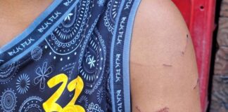 Grade 7 Student Suffers Injuries After Alleged Beating by Teacher in Bacolod