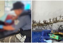 Senior Citizen Dies After Being Hit on the Head by Man Who Was Denied Cigarette